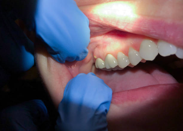 Best Dentist for Dental Trauma  in Parshall, ND